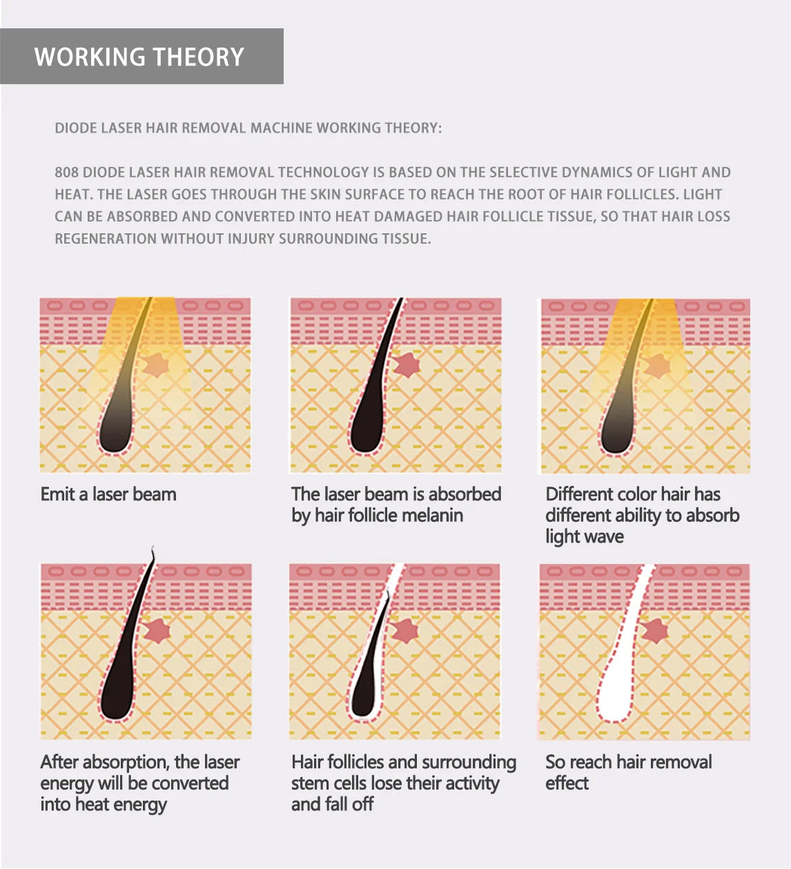 Emszero Soprano Diode Laser Hair Removal Machine 808nm