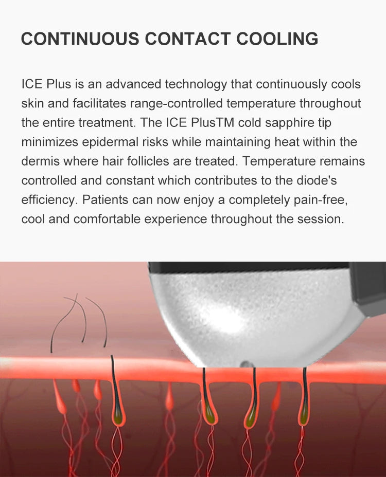 Emszero Soprano Diode Laser Hair Removal Machine 808nm